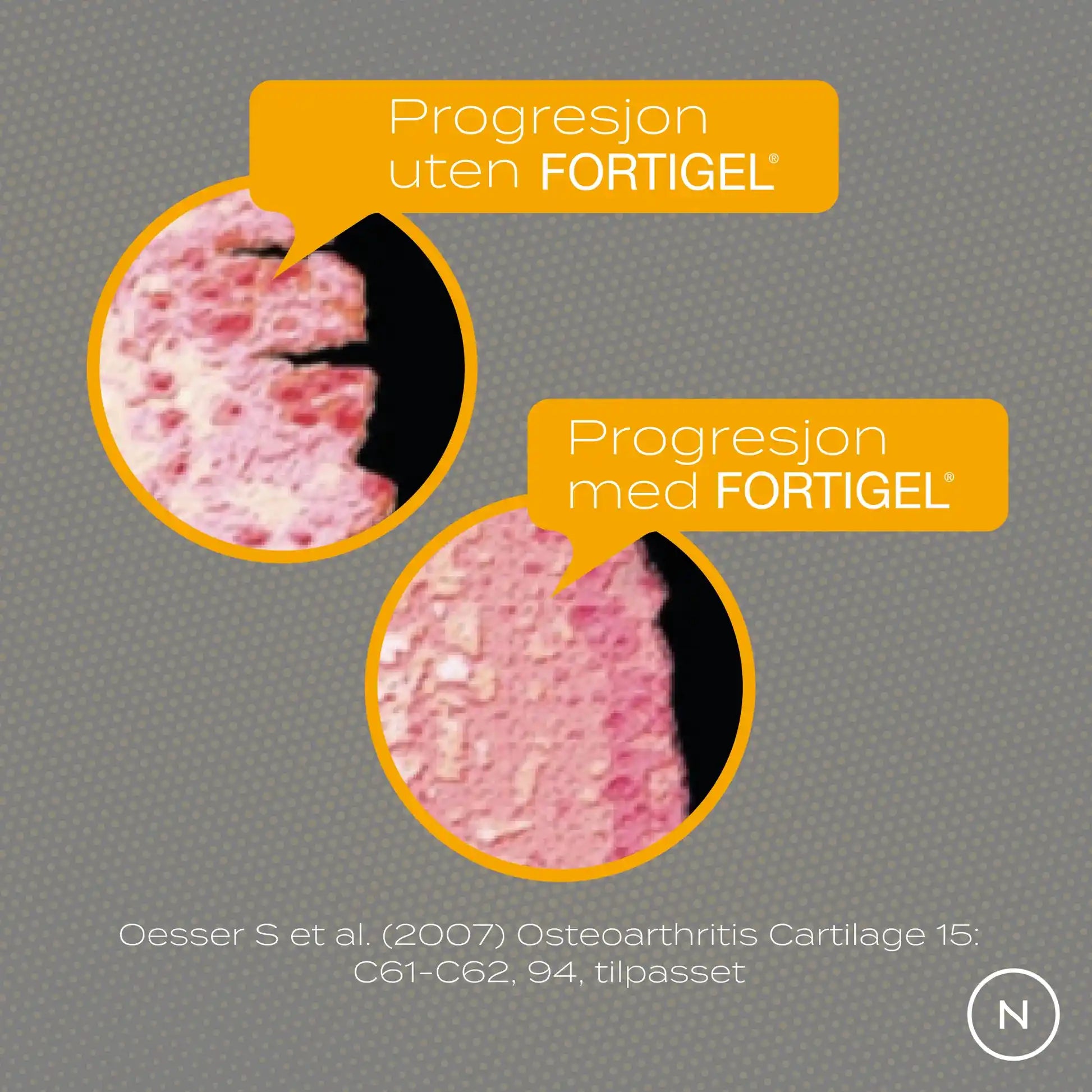 Fortigel progresjon