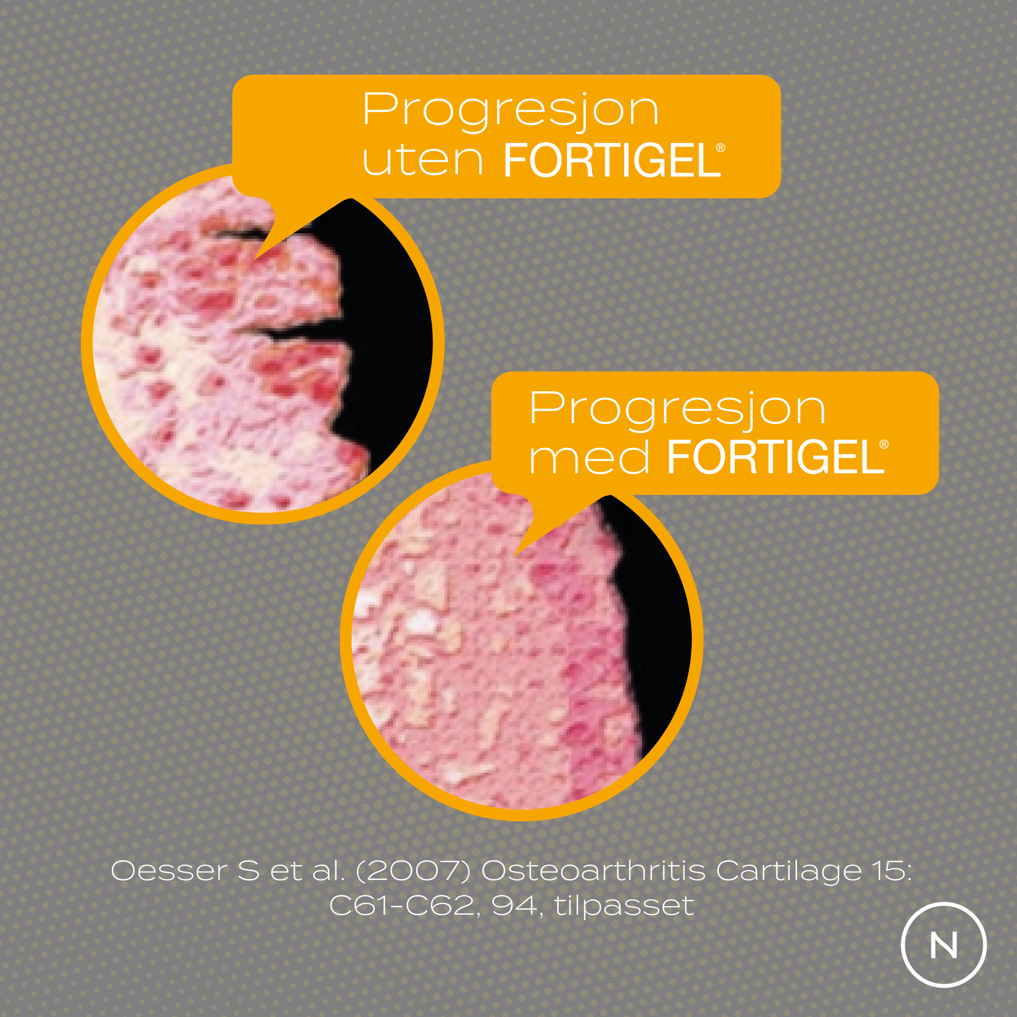 kollagen progresjon uten fortigel och med
