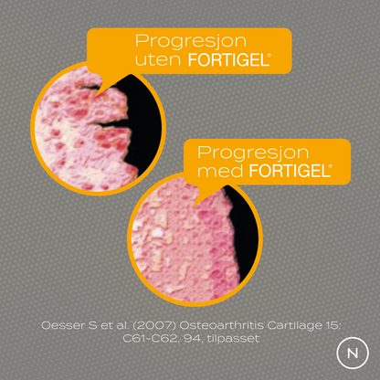 kollagen progresjon uten fortigel och med